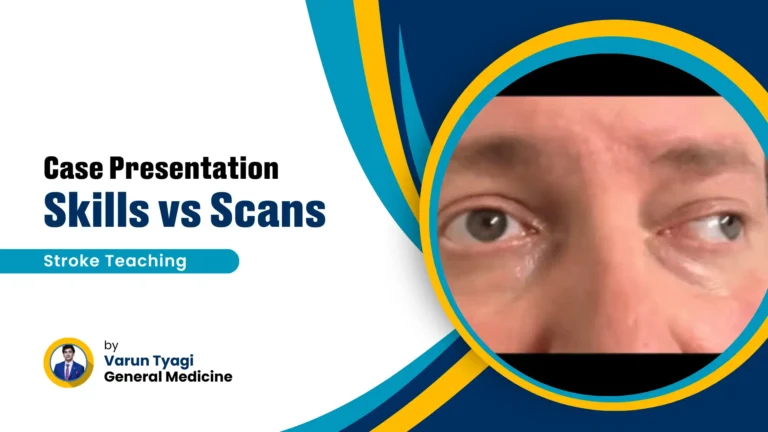 Case Presentation Varun, Stroke Teaching